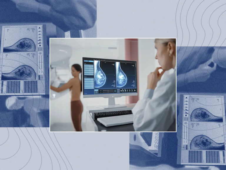 Будет ли маммограмма делать имплантаты груди?